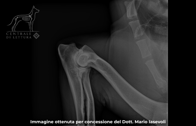 Posizione gomito MLF  – Grado 0